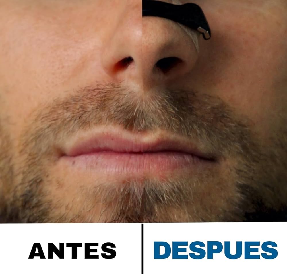 AirFlex™ - Tiras Nasales Magnéticas